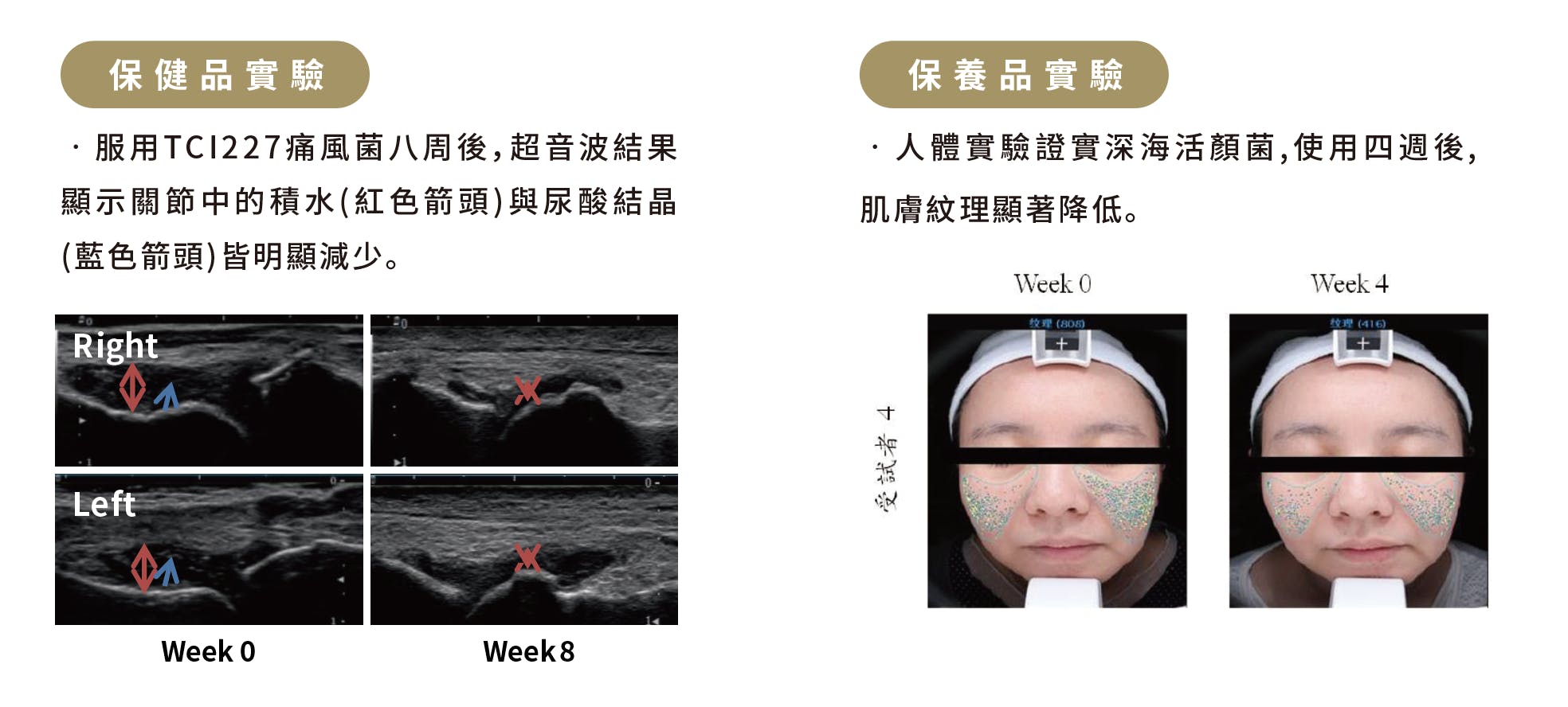 TCI 全球保健食品代工廠/ODM/OEM/CDMO，長年與各國內外頂尖大學醫學中心合作，臨床功效驗證，提供客製化實驗數據效果驗證報告，帶給客戶及消費者最佳的產品功效保證。